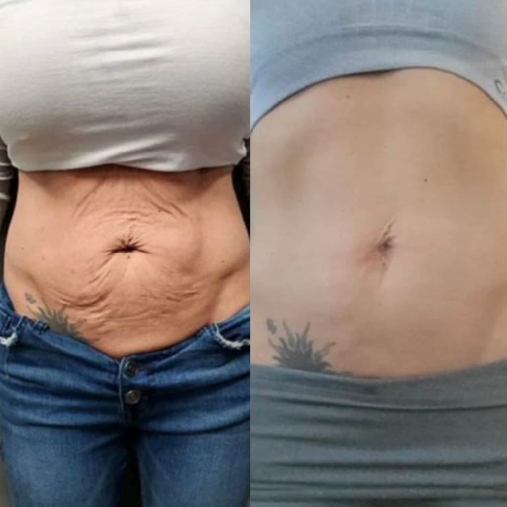 Sorelux Red Light Therapy Belt