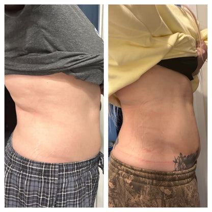 Sorelux Red Light Therapy Belt